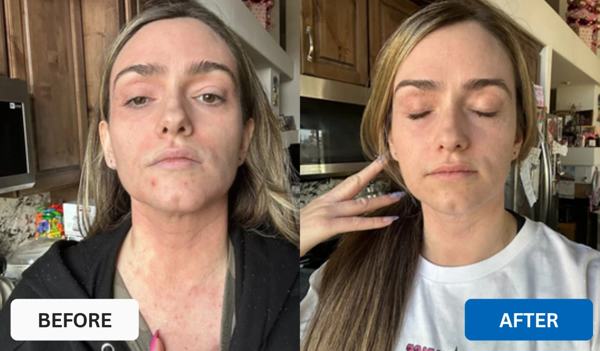 before and after